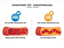Thực phẩm giúp giảm cholesterol xấu trong cơ thể.